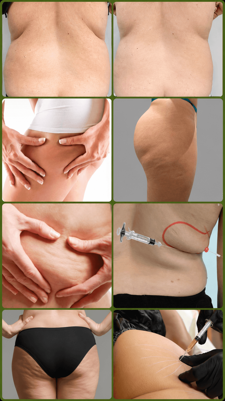 Valoración médica para recomposición corporal en Longeva